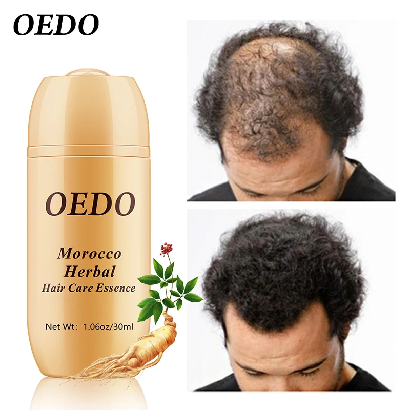 

Moroccan Hair Growth Serum Anti-hair Loss Liquid Quickly Grows Hair Dry Frizzy Hair Repair Man Woman Damaged Thinning Care 30ML