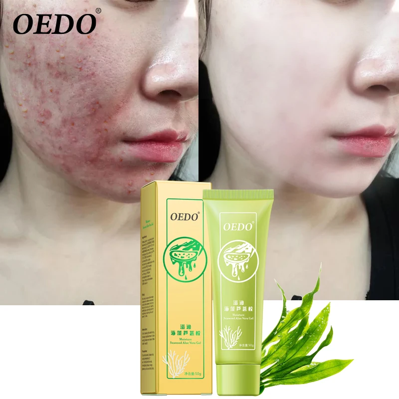 

Seaweed Aloe Gel Acne Treatment Moisturizing Whitening Cream Remove Scar Mark Shrink Pore Smooth Skin Moisturizing Face Care