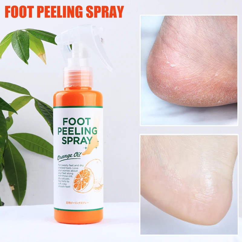 Foot Exfoliating Spray Moisturizing Hydrating Cleaning Smoothing Skin Care Women Girl Ladies J3 |