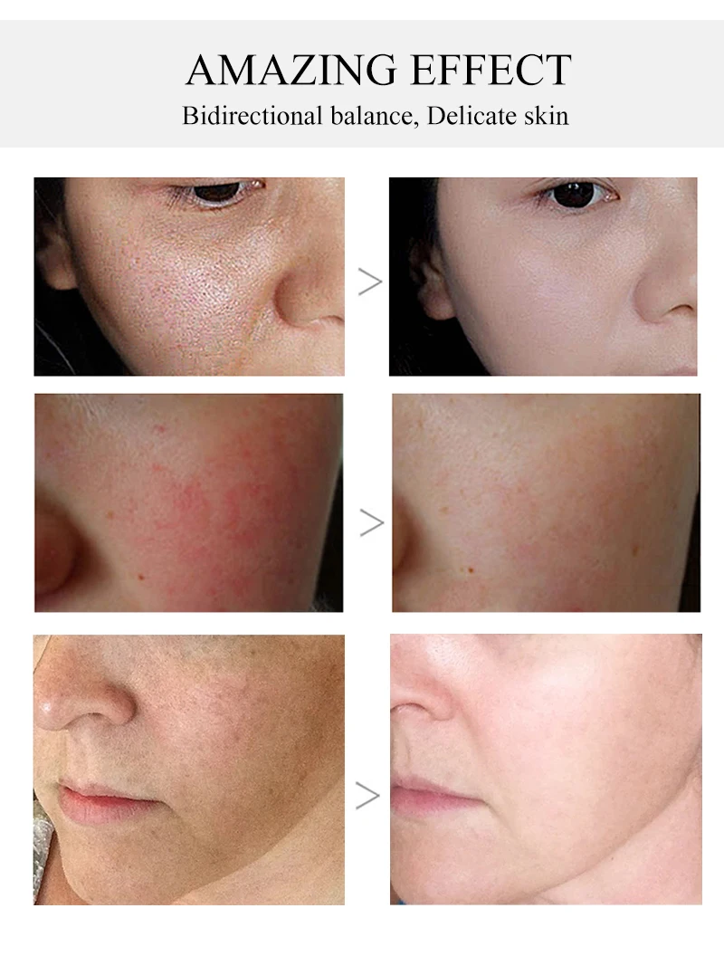 

EFERO Hyaluronic Acid Face Serum Anti-Aging Shrink Pore Whitening Moisturizing Remove Acne Essence Face Cream Dry Skin Care