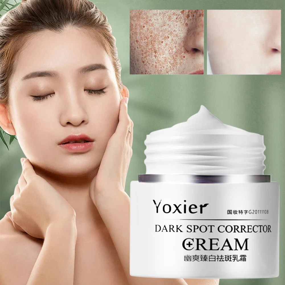 

Face Cream Yoxier Dark Point Correction Anti-aging Bleaching Moisturizer Remove Sun Burns Dark Spots And Pigmentation Acne 30g