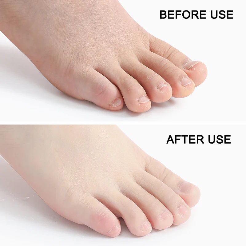 Foot Exfoliating Spray Moisturizing Hydrating Cleaning Smoothing Skin Care Women Girl Ladies J3 |