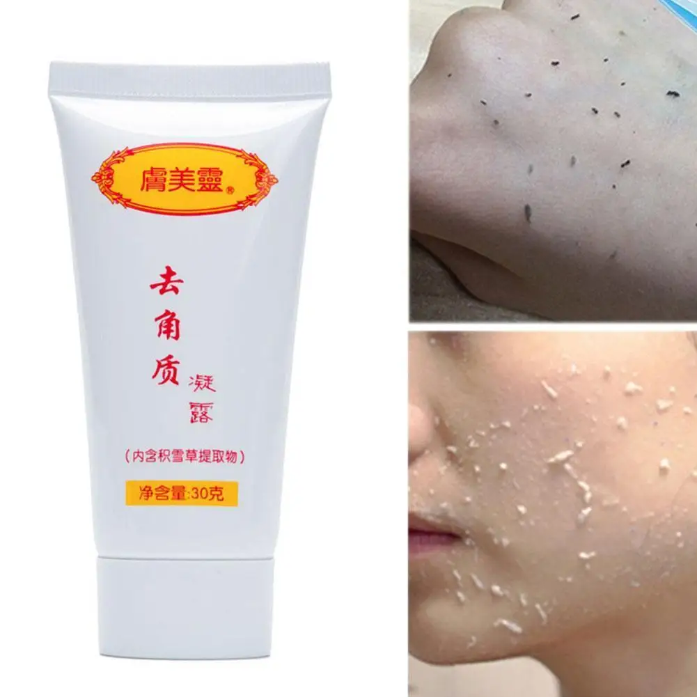 

Deep Exfoliating Peeling Gel Moisturizing Face Exfoliating Skin Gel And Cleansing Skin Dead Care Body For Face Gel Removal N4Q9