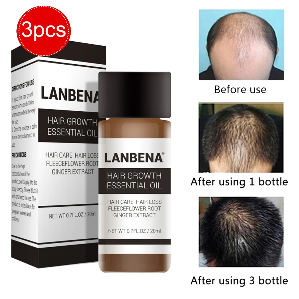 3pcs LANBENA 20 мл эссенция для роста волос Быстрый мощный Уход за волосами Эфирное Масло жидкое лечение Предотвращение выпадения волос для мужчин и женщин - Цвет: 3pcs
