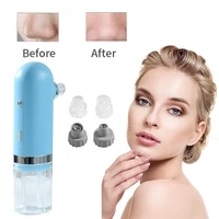 3 modes blackhead remover acne face care home use devices facial cleaning skincare black point vacuum cleaner beauty appliances