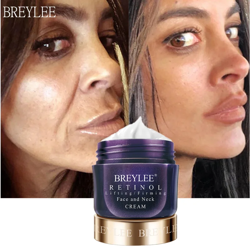 

BREYLEE Retinol Firming Face Cream Anti-Aging Wrinkle Removal Day Cream Firming Lifting Whitening Brighten Skin Night Cream 40g