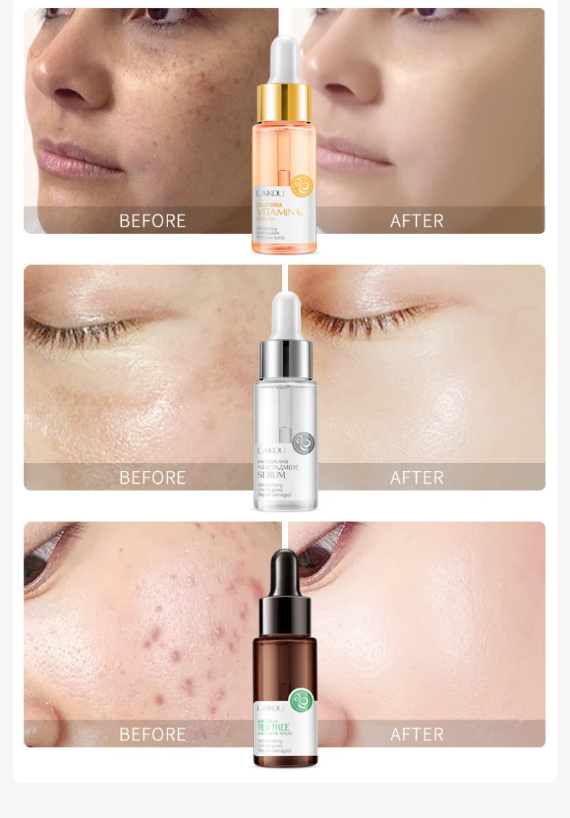 5 Styles Face Serum Essence Whitening Oil Control Anti-Aging Hyaluronic Tea Tree Acid Pure Vitamin C Skin Care Dropship TSLM1 | Красота и