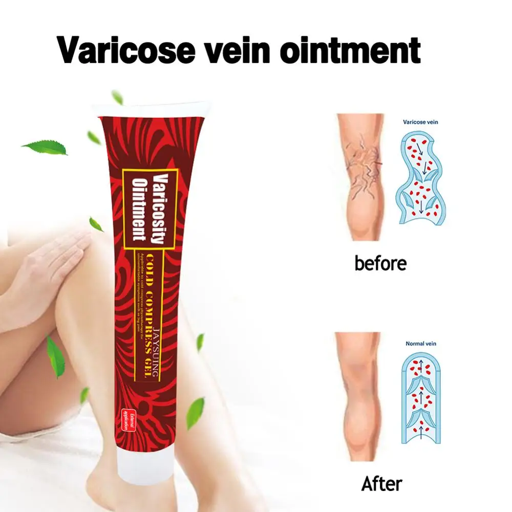 Варикоз веновая мазь Драга кровеносные сосуды варикозное расширение Паутинные