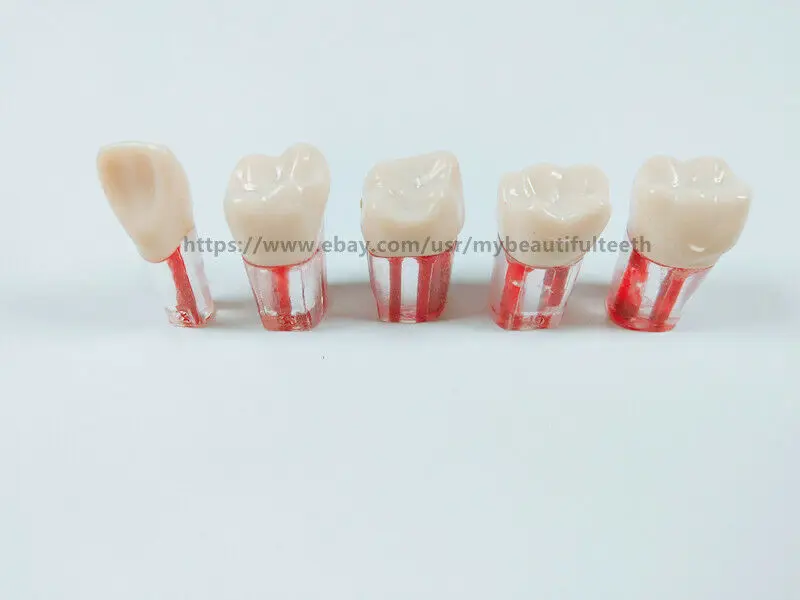 5 шт./лот стоматологические эндокорневые пульпы для корневых каналов