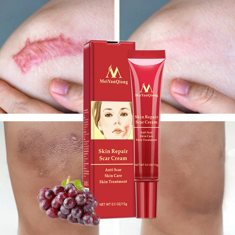 

Acne Scar Removal Face Cream Acne Spots Acne Pigmentation Corrector Whitening Gel Anti Scar Stretch Marks Repair Skin Care