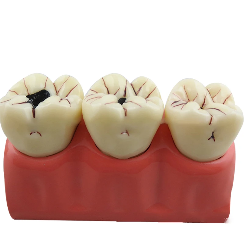 4х увеличенные Ортодонтические Брекеты для ухода за полостью рта новая модель