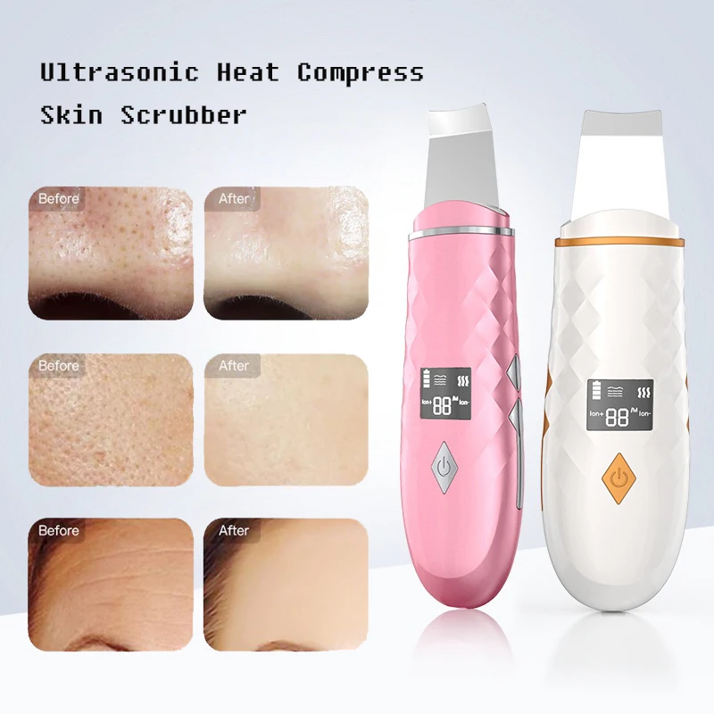 Ультразвуковой аппарат для удаления угрей лица CF044 ионная вибрация горячий