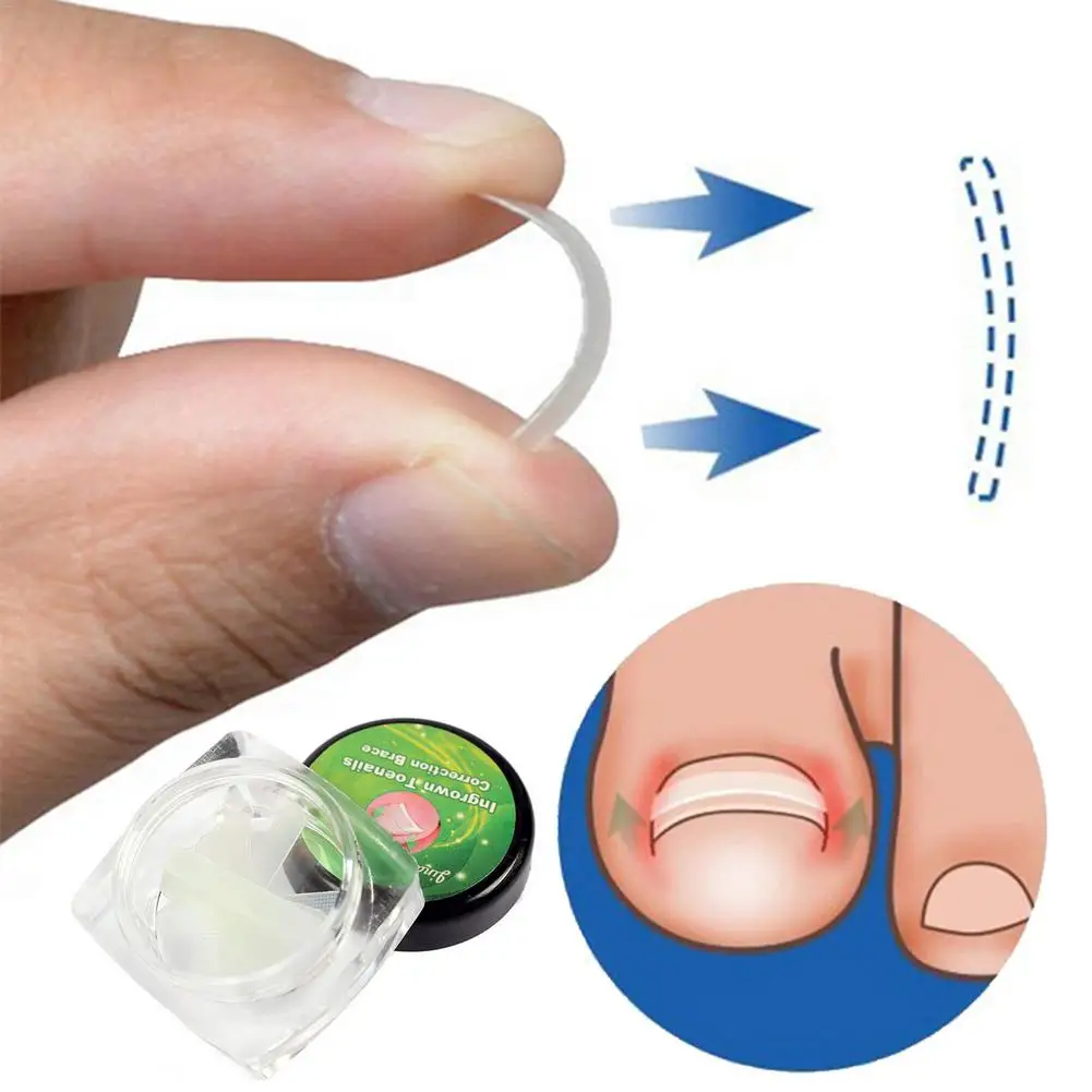 10 шт. набор инструментов для коррекции ногтей | Красота и здоровье