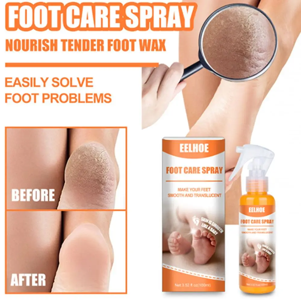 

prevent peeling moisturize Feet Knees Remove Calluses Remove Dead Skin Foot Exfoliating Foot care spray