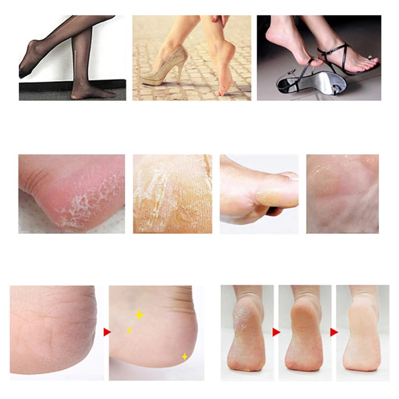 1 Набор инструментов для ухода за ногами из нержавеющей стали инструмент