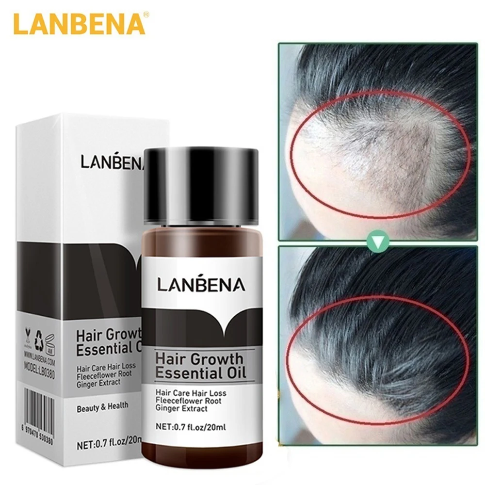 Эссенция для роста волос с имбирем LANBENA питательный раствор предотвращения