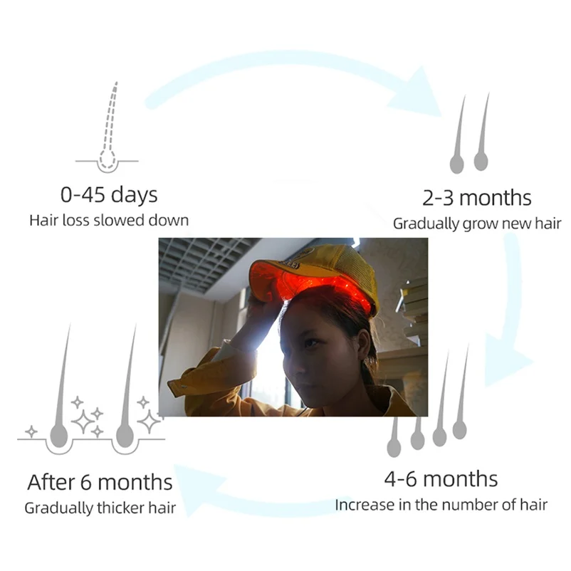 

Колпачок для роста волос для лазерной терапии, устройство против выпадения волос, лечение против выпадения волос, шапочка для роста, массажное оборудование унисекс
