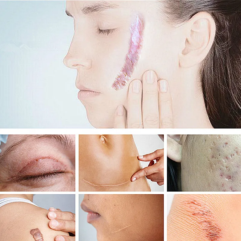 

Lavender Scar Repair Cream Moisturizing and Nourishing Skin Improving Skin Cream
