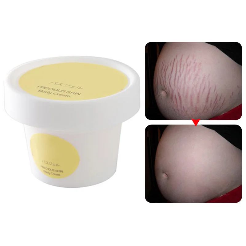 

Stretch Mark Cream Scar Cream Repair Anti-Aging Anti-Winkles Firming Body Creams for Pregnancy M2