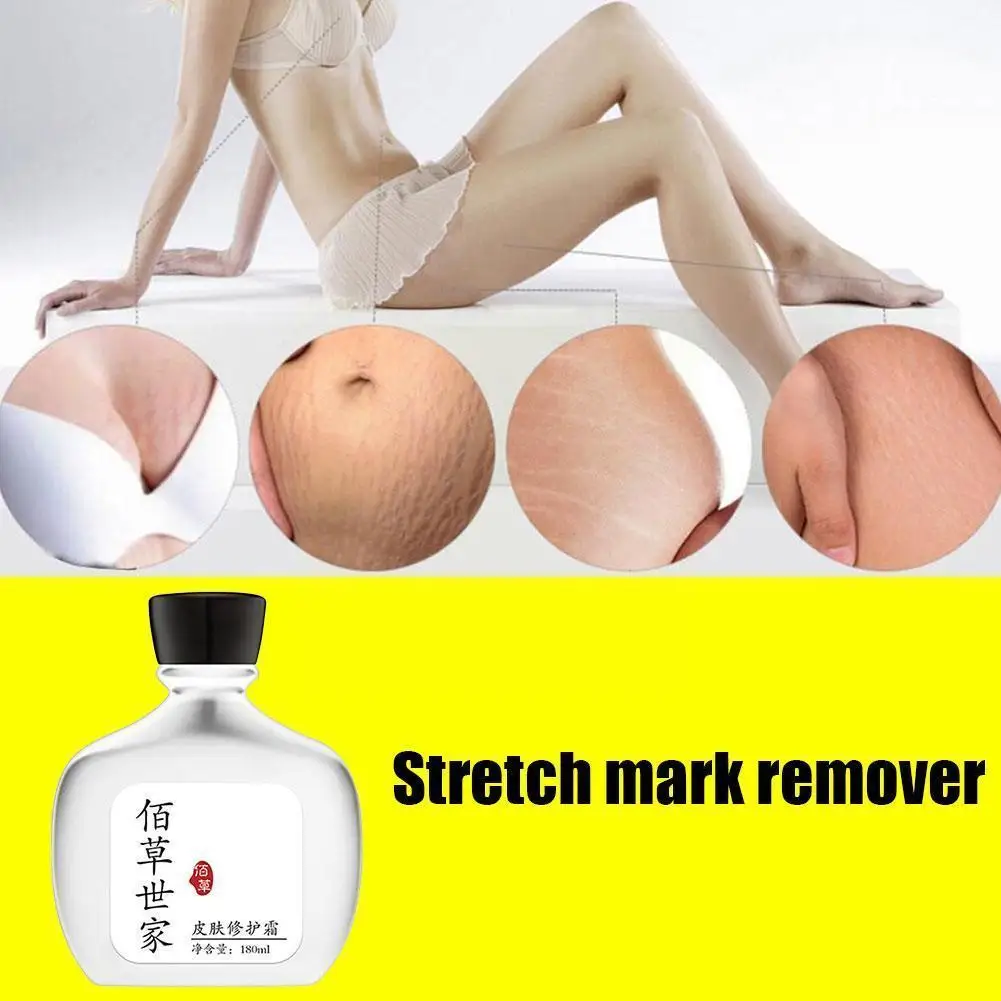 

Pregnancy Repair Cream Stretch Marks Reversal Cream Cream Marks Growth Obesity Remove Remover Lines Stretch Tight Thighs L5G7