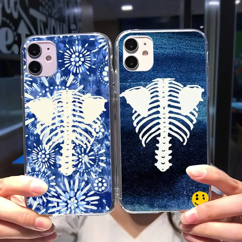 

Japanese Fashion Kapital Phone Case For Iphone 11 12 13 Pro Max 5s 6s 7 8 Plus X Xr Xs Max Se 202Mini Transparent Case Cover
