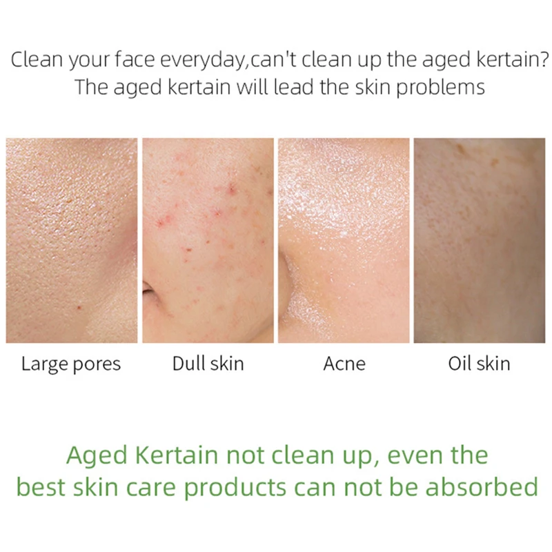 Organic Friut Acid Facial Exfoliator Body Scrub Peeling Cream Face Gel Clean Dirt Dead Shrink Pores Lemon 80g |