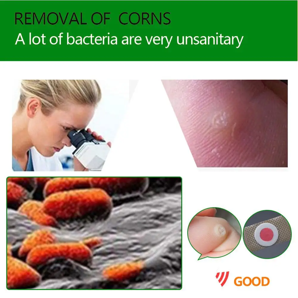 XY Fancy 42 шт. пластырь для удаления мозолей старый кокон шип ног кукурузная паста