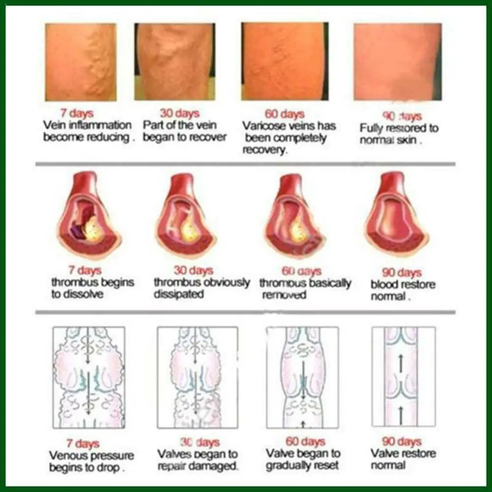 

Из натуральных материалов с натуральным растительным экстрактом эфирное масло T5G6
