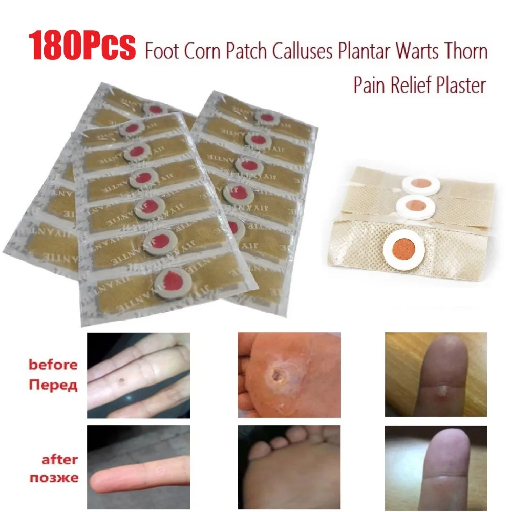 Медицинский пластырь для удаления мозолей ног 180 шт./лот|Пластыри
