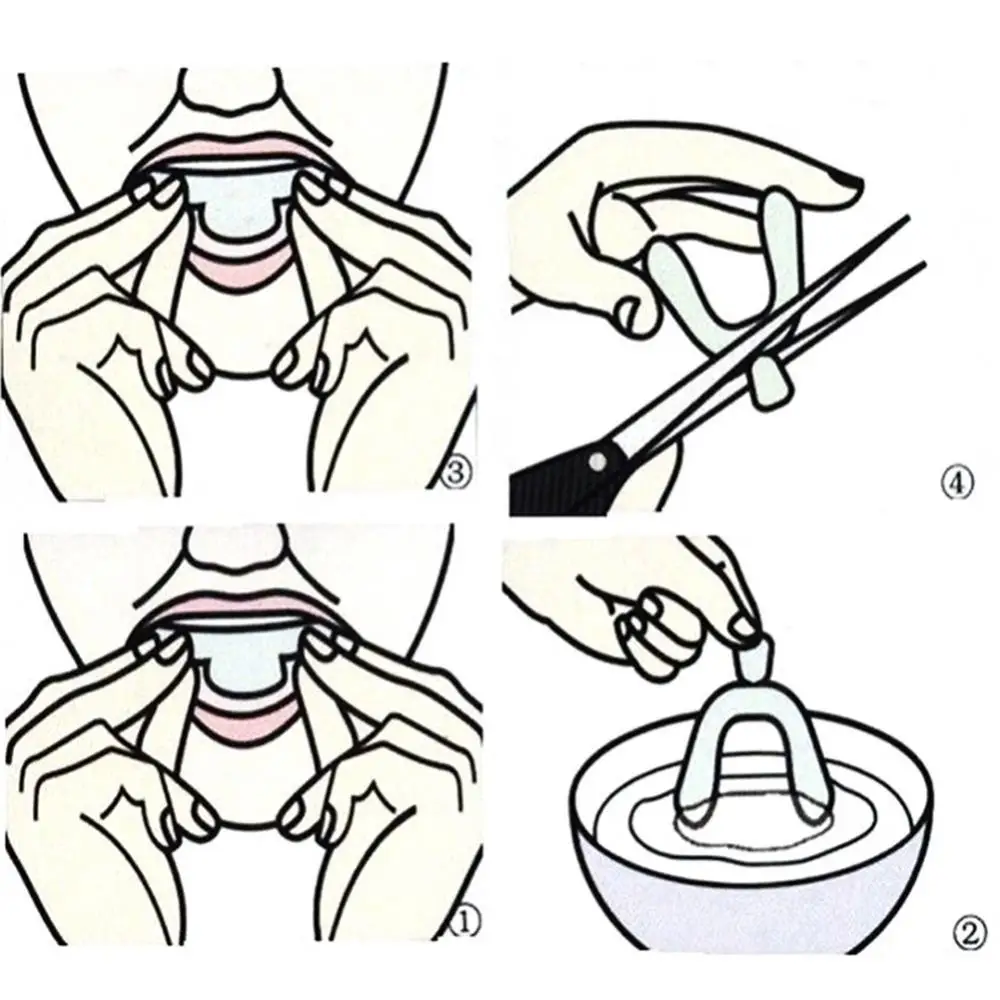 

Hot Sales 2Pcs Food Grade Silicone Thermoform Teeth Whitening Tray Dental Care Mouth Guard