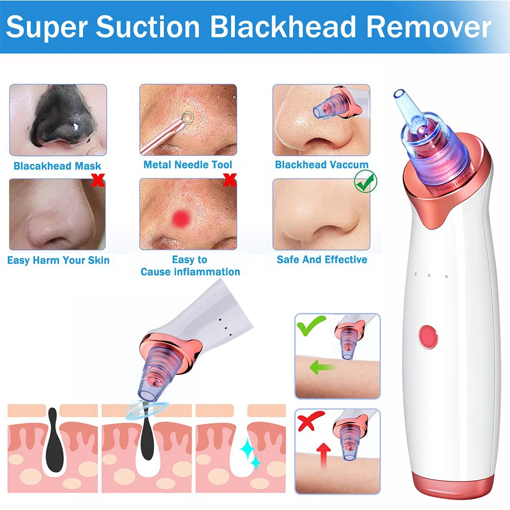 Вакуумное устройство для удаления черных точек на лице с 5 щупами|Устройство
