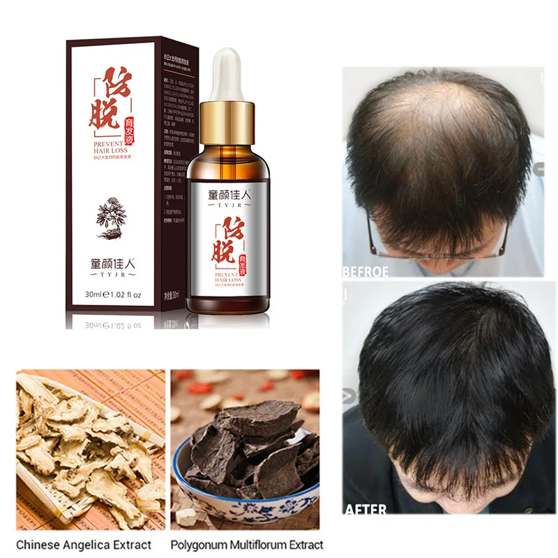 30 мл средство против выпадения волос быстрое для эссенция масло натуральные