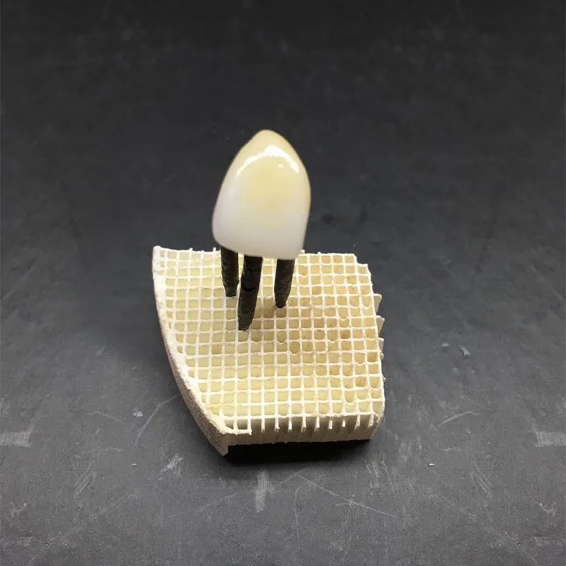 Hahasmile 4D-Multilayer Zirconia Blocks Dental Lab 98-A3.5 Hardness 1250Hv 12mm/14mm/16mm/18mm/20mm/22mm/25mm High Quality