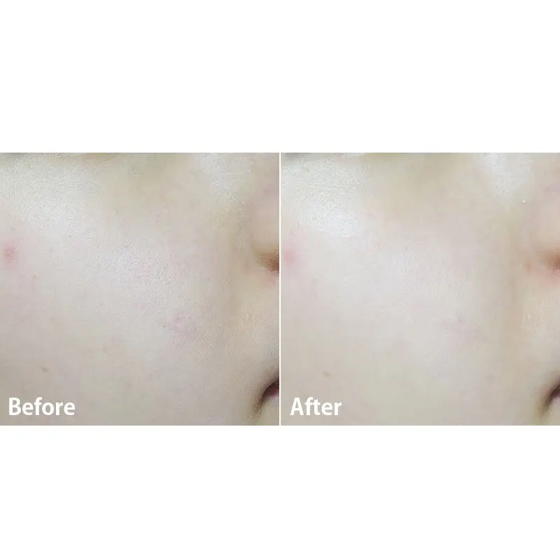 

MISSHA Time Revolution The First Essence 5X 150ml Face Cream Moisturizing Firming Facial Serum Korea Cosmetics