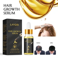 20 ml ginger fast hair growth dense regrowth serum oil anti loss treatment essence hair serum growth liquid care hair care