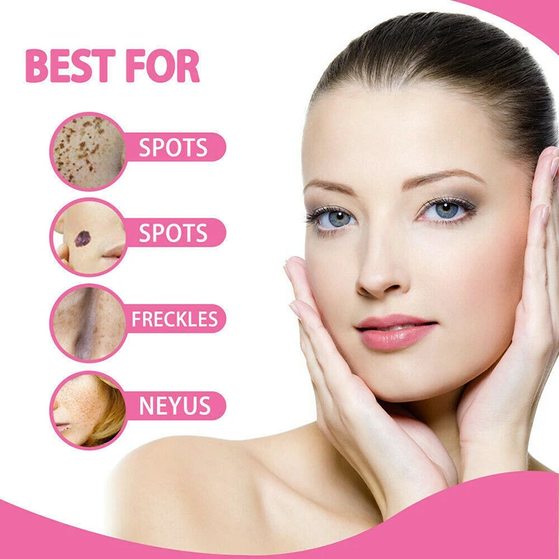 

Painless Mole Skin Tag Repair Solution Mole Skin Dark Spot Repair Face Wart Tag Freckle Repair Cream Oil TSLM1