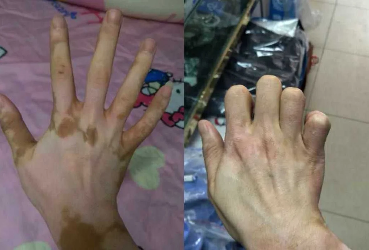 30 мл-100 мл монобензонизирующий крем 20% для обесцвечивания |