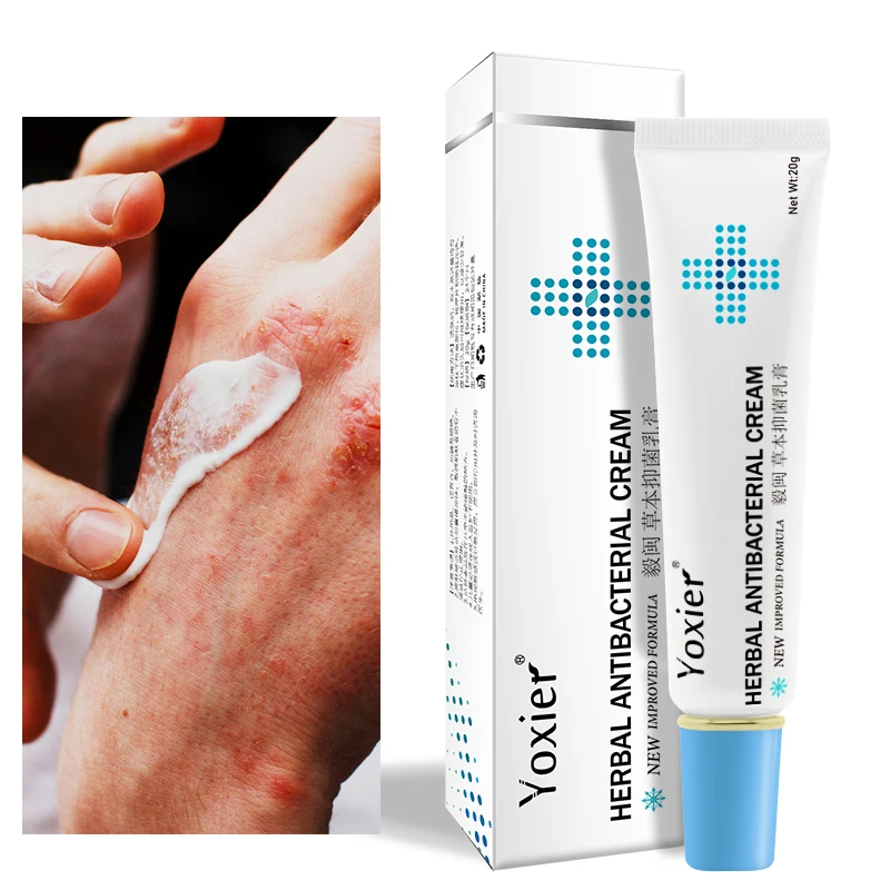 

Yoxier Herbal Antibacterial Cream Psoriasis Cream Anti-itch Relief Eczema Skin Rash Urticaria Desquamation Treatment 20G