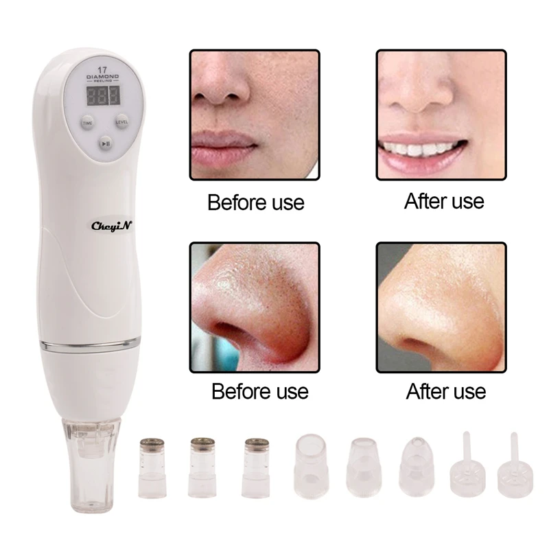 Присоска для лица удаления черных точек акне морщин микродермабразии машинка