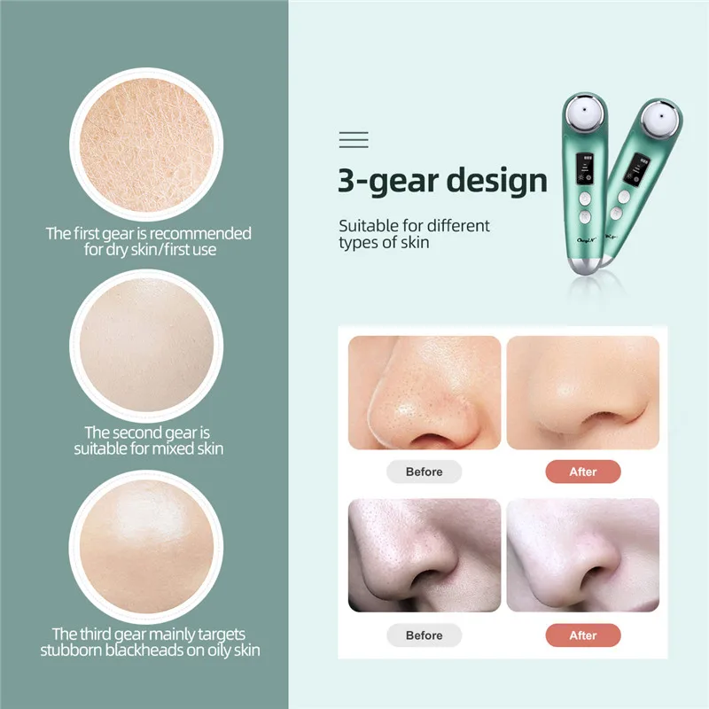 

Facial Blackhead Remover Hot And Cold Compress Electric Pore Cleaner Multifunction Black Point Vacuum Tool