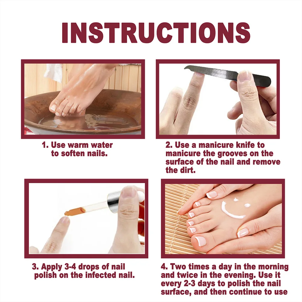 

Nail Repair Essence Nail Fungus Treatment for Cracked Rough Fungal Nails Strengthen Damaged Nails of Fingernails Toenails