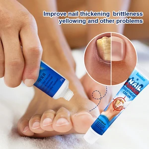 20g Nails Fungus Treatment Cream Whitening Onychomycosis Toenail Fungal Removal Paronychia Anti Infection Feet Nail Care Gel