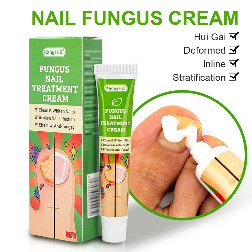 

20g Fungal Nail Treatment Serum Nail Foot Nail Fungus Removal Gel Anti Infection Onychomycosis Nail Repair Cream Feet Nail Care