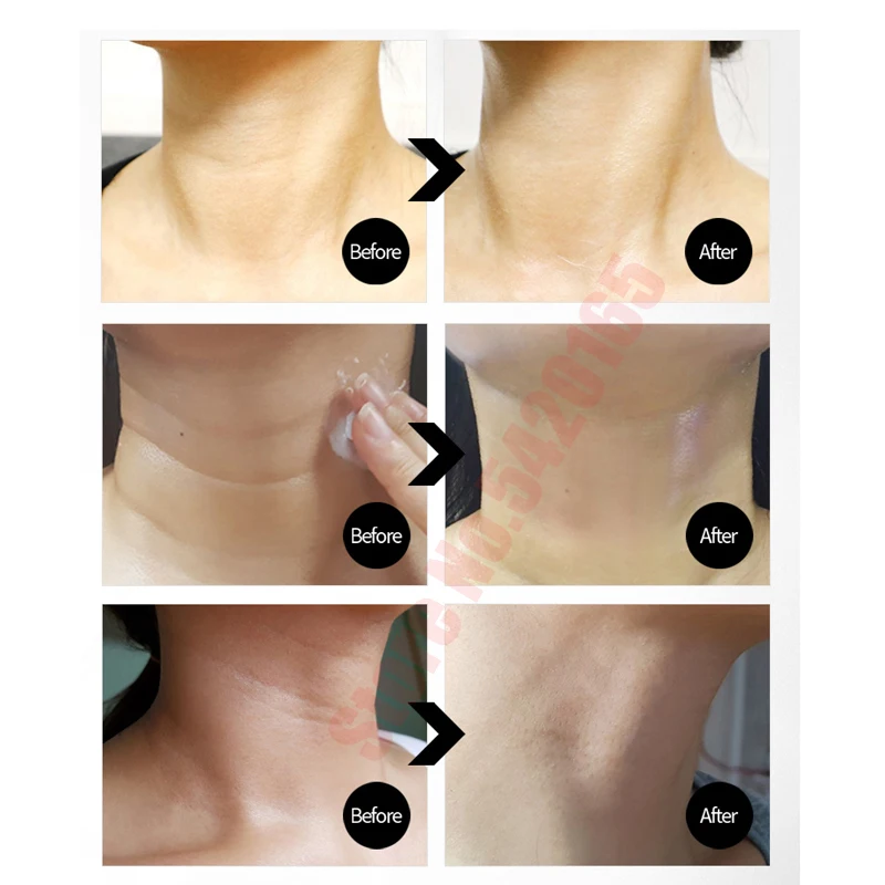 100 мл корейский оригинальный 5% аденозин нитями шеи крем гидролизованный коллаген