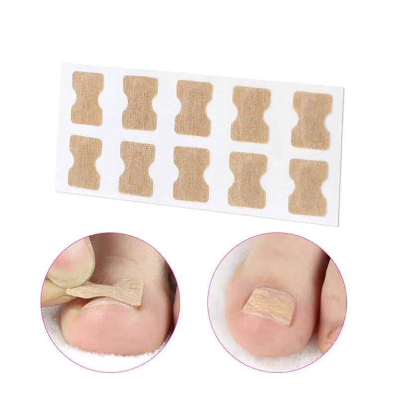 

10Pcs/50Pcs Nail Art Ingrown Correction Sticker Foot Care Pedicure Tool Fixer Paronychia Recover Toenail Elastic Patch Corrector