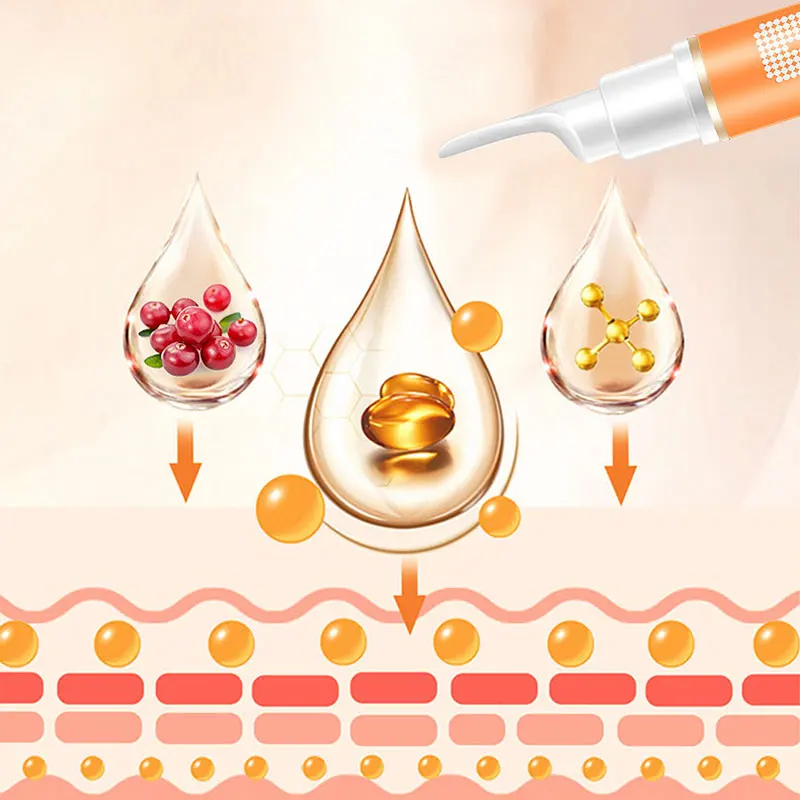 Мгновенное удаление пятен гель для удаления веснушек Отбеливающая увлажняющая