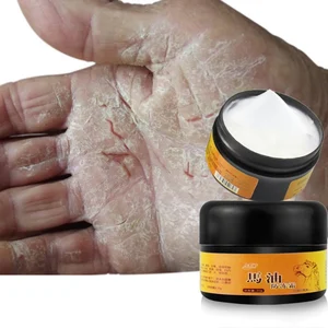 30 г полезные на основе конского жира, крем для ног защита от растрескивания кожей увлажняющий крем для сухой и потрескавшейся потрескавшуюся кожу ног Каблук