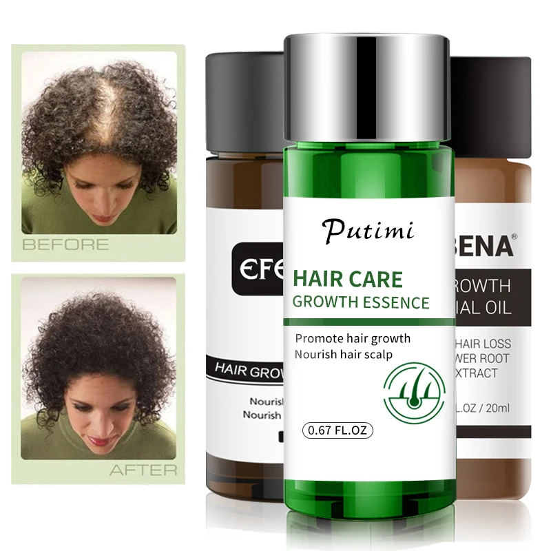 1/2 шт. сыворотка для эффективного роста волос|Средства от выпадения волос| |