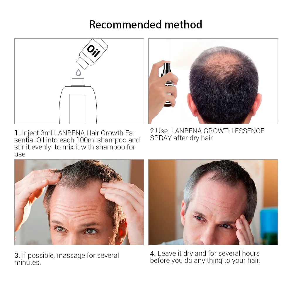 2 шт. эссенция для роста волос и предотвращения облысения|Средства от выпадения