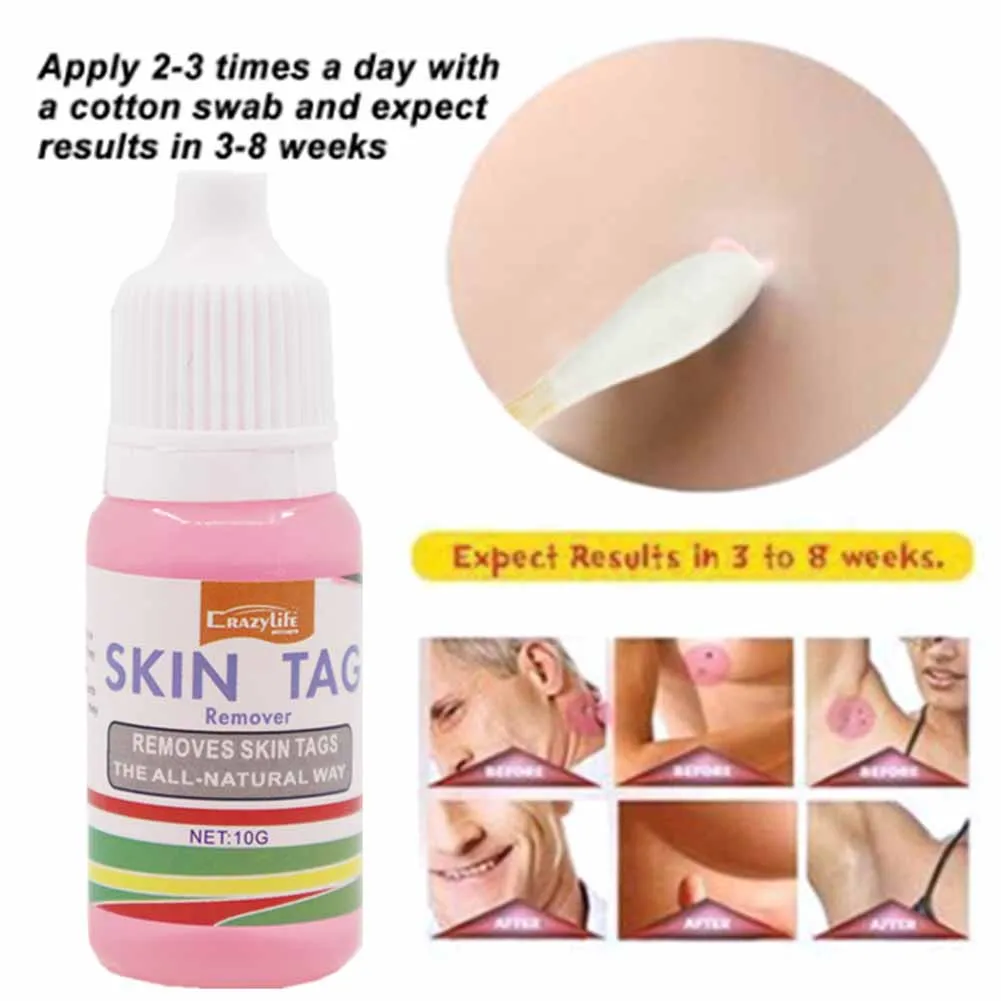 

Средство для удаления бородавок безболезненные этикетки для удаления мозолей, устройство для удаления небольших и средних этикеток кожи, ж...